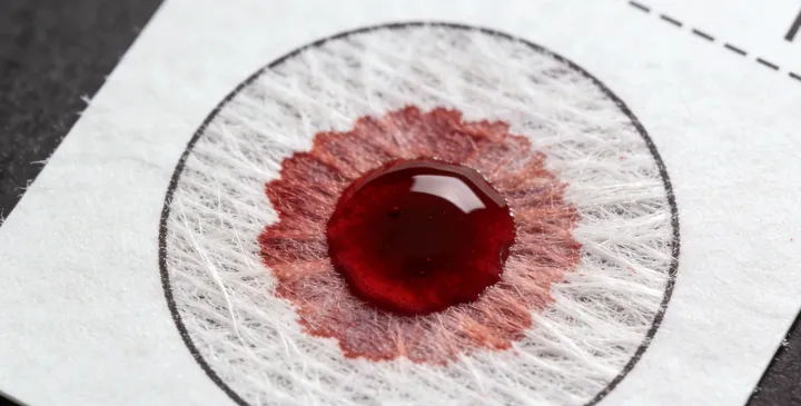 诸城亲子鉴定采样过程 诸城亲子鉴定采样过程