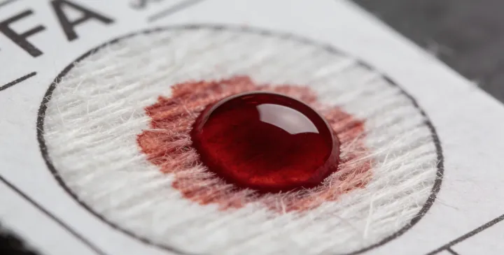 六枝特亲子鉴定采样过程 六枝特亲子鉴定采样过程